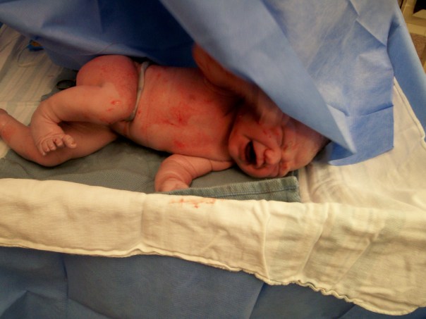 2009-08-04 0853p adaline01