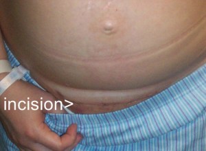 2009-08-06 scar 100_1538actxt